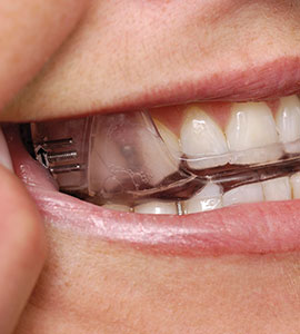 Anti-Snoring Devices | Brisbane